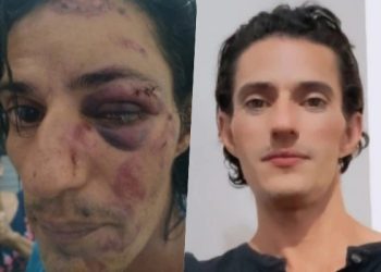 Homem é agredido e encontrado desacordado em Gravatá