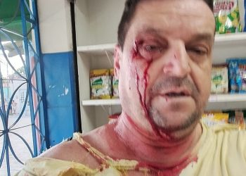 Mãe e irmã de Viviane Facundes, esposa do prefeito de Gravatá, agridem crítico com barra de ferro em via pública