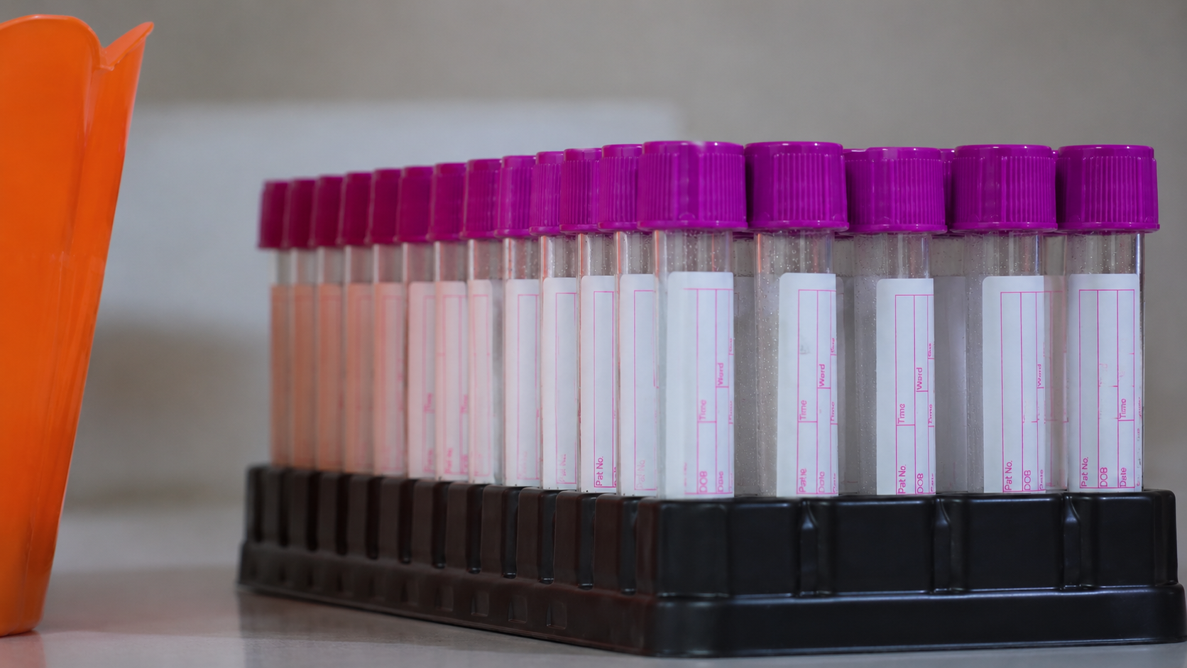 Tubos de ensaio limpos com tampas roxas e etiquetas de identificação em suporte de laboratório.